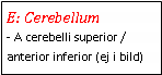 Text Box: E: Cerebellum- A cerebelli superior / anterior inferior (ej i bild)