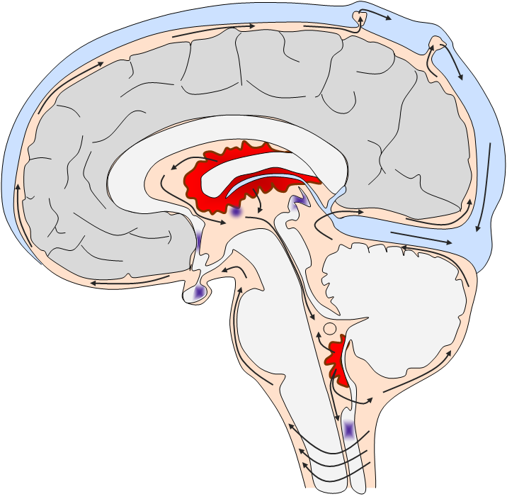 Ликворные изменения мозга